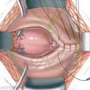 Surgery Surgery