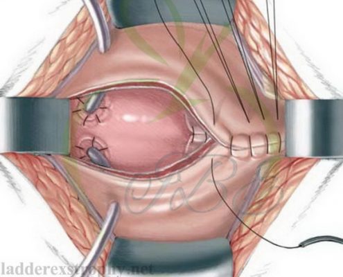 Surgery