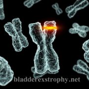 The cause bladder exstrophy (1) The cause bladder exstrophy