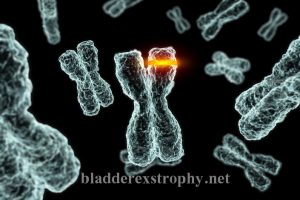 The cause bladder exstrophy