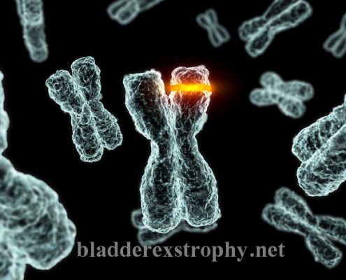 The cause bladder exstrophy